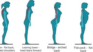 What Poor Posture Can Do to Your Body Over time