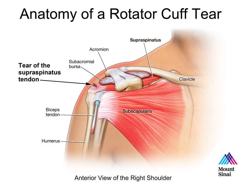 Emanuel’s Rotator Cuff Insight