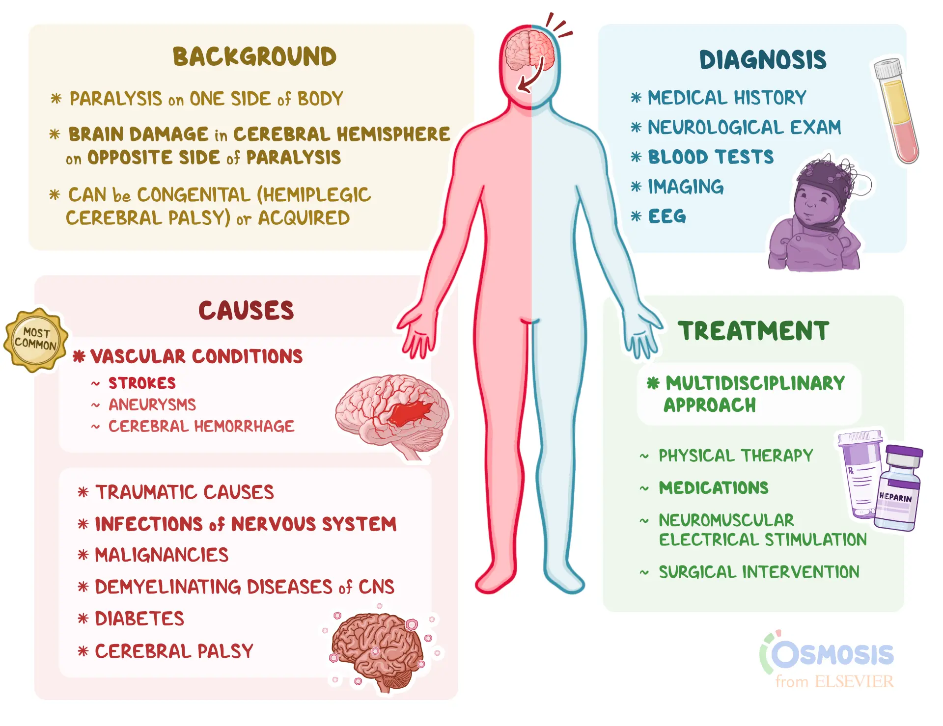 Hemiplegia